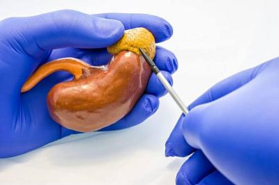 Study in early diagnosis of adrenal carcinoma